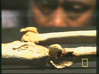 Floresian Hip joint