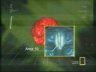 Hobbit Brain Area 10