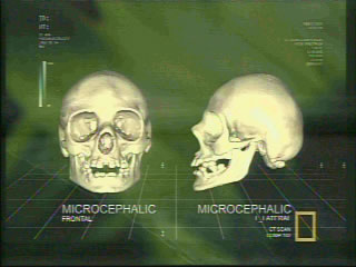 The Microcephalic Skull is smaller than the Hobbit Skull