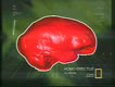 Homoerectus Brain