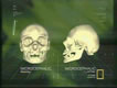 Microcephalic Skull